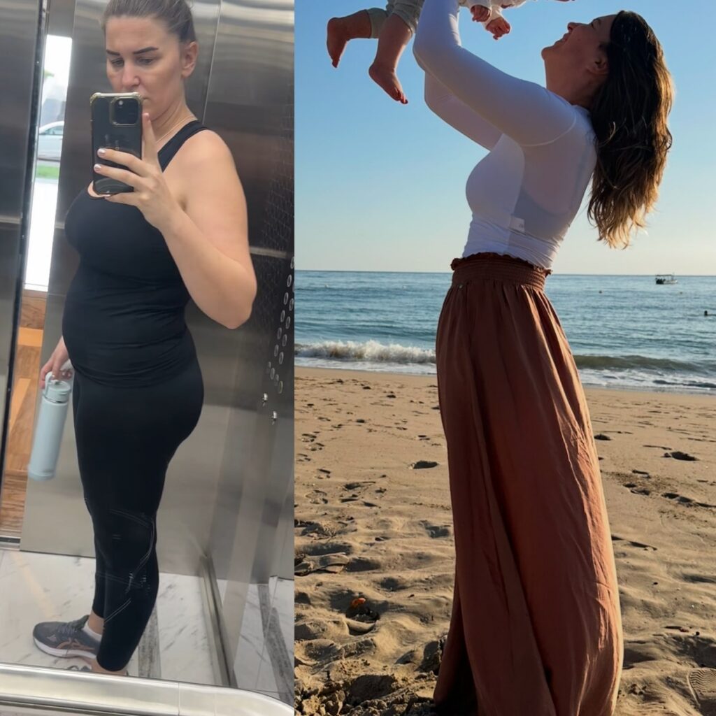 Ena before and after