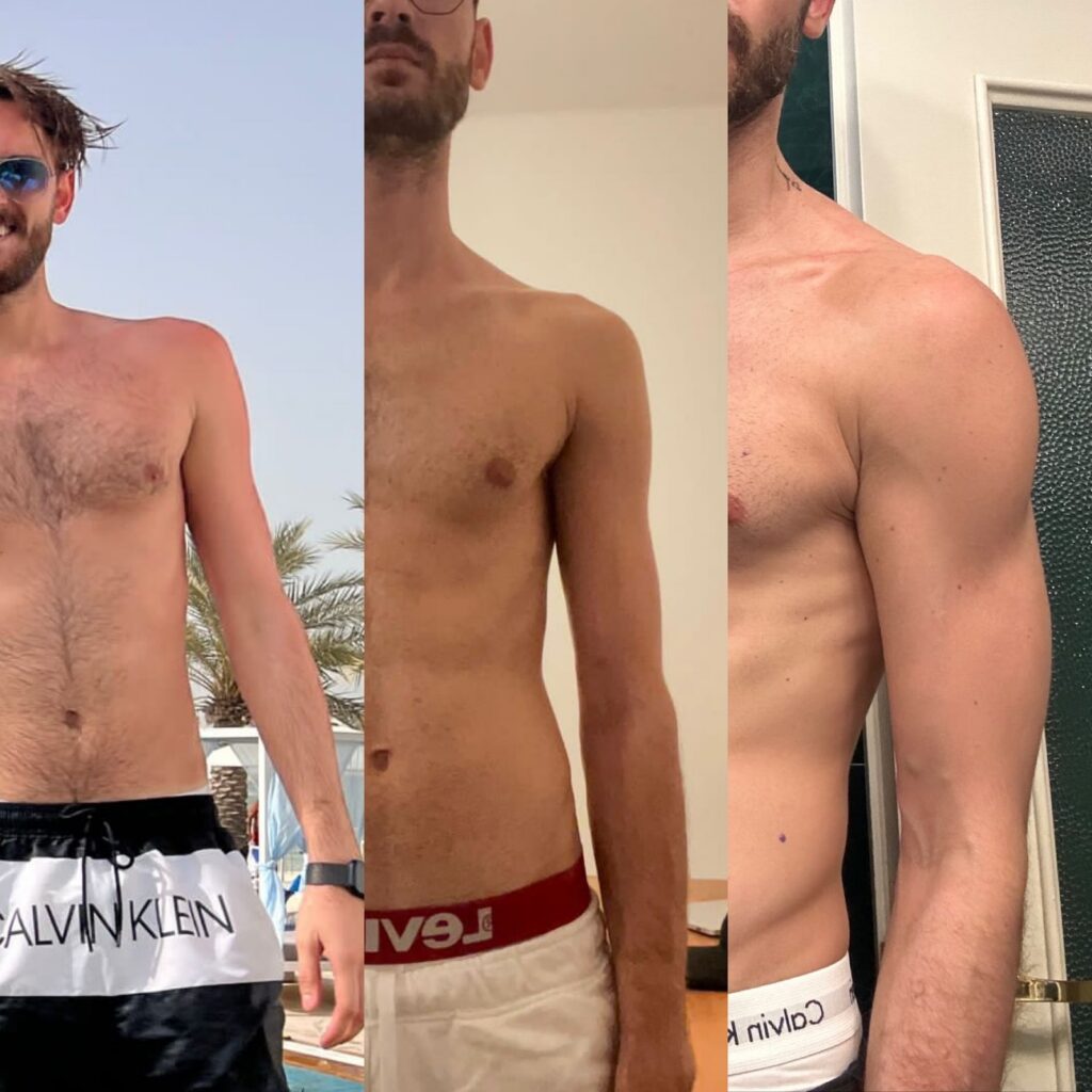 Ziad before and after