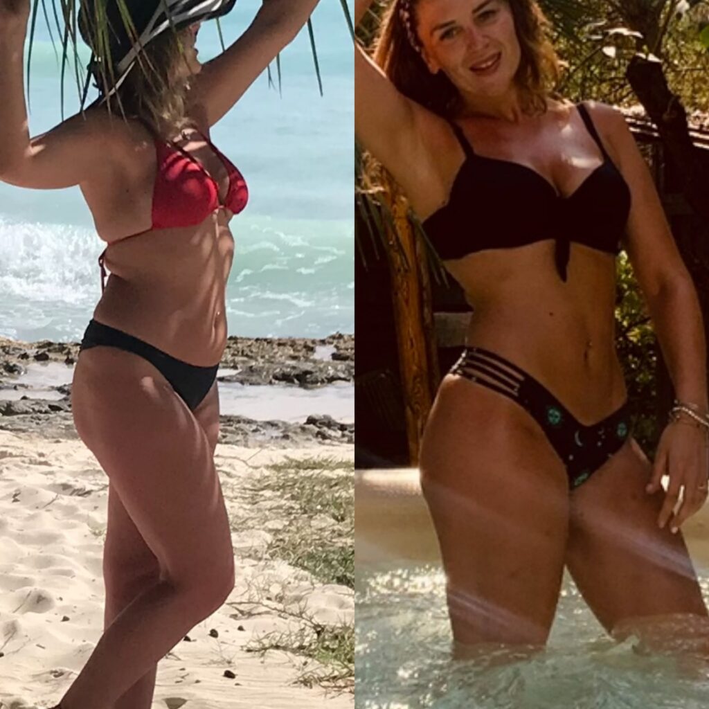 Ena before and after