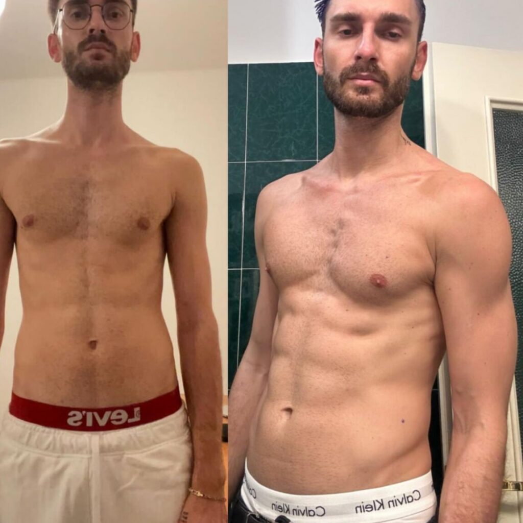 Ziad before and after